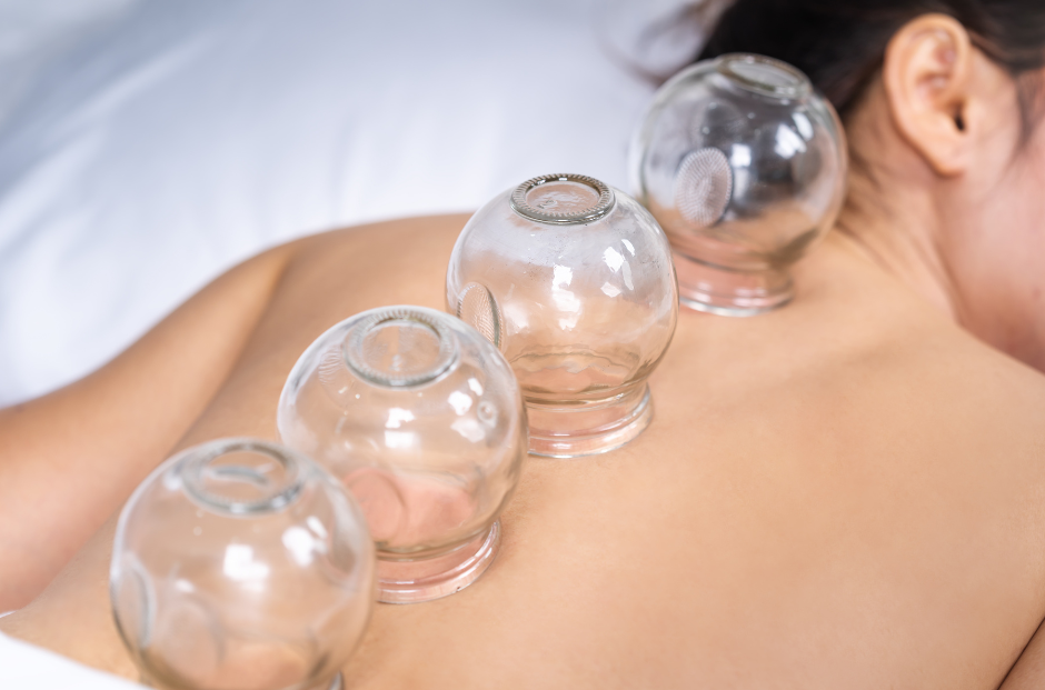 cupping